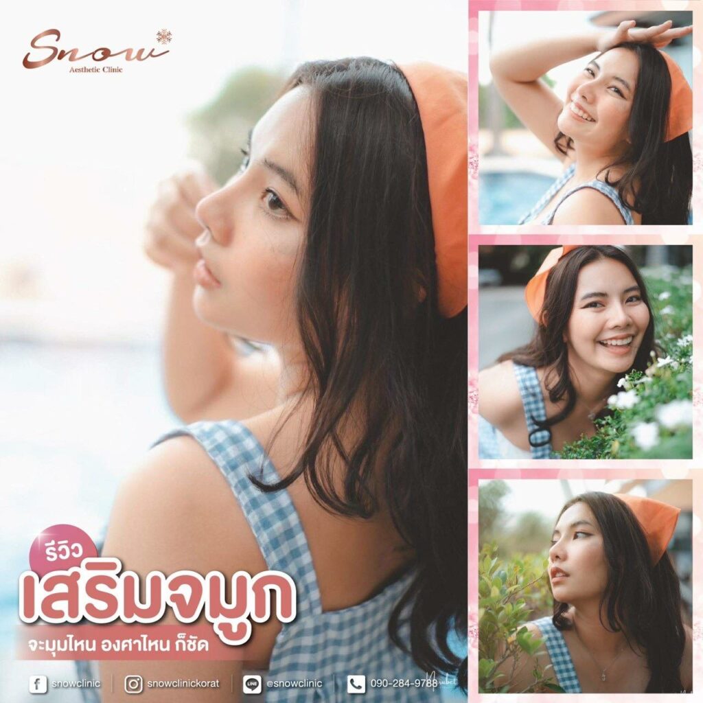 เสริมจมูกโคราช