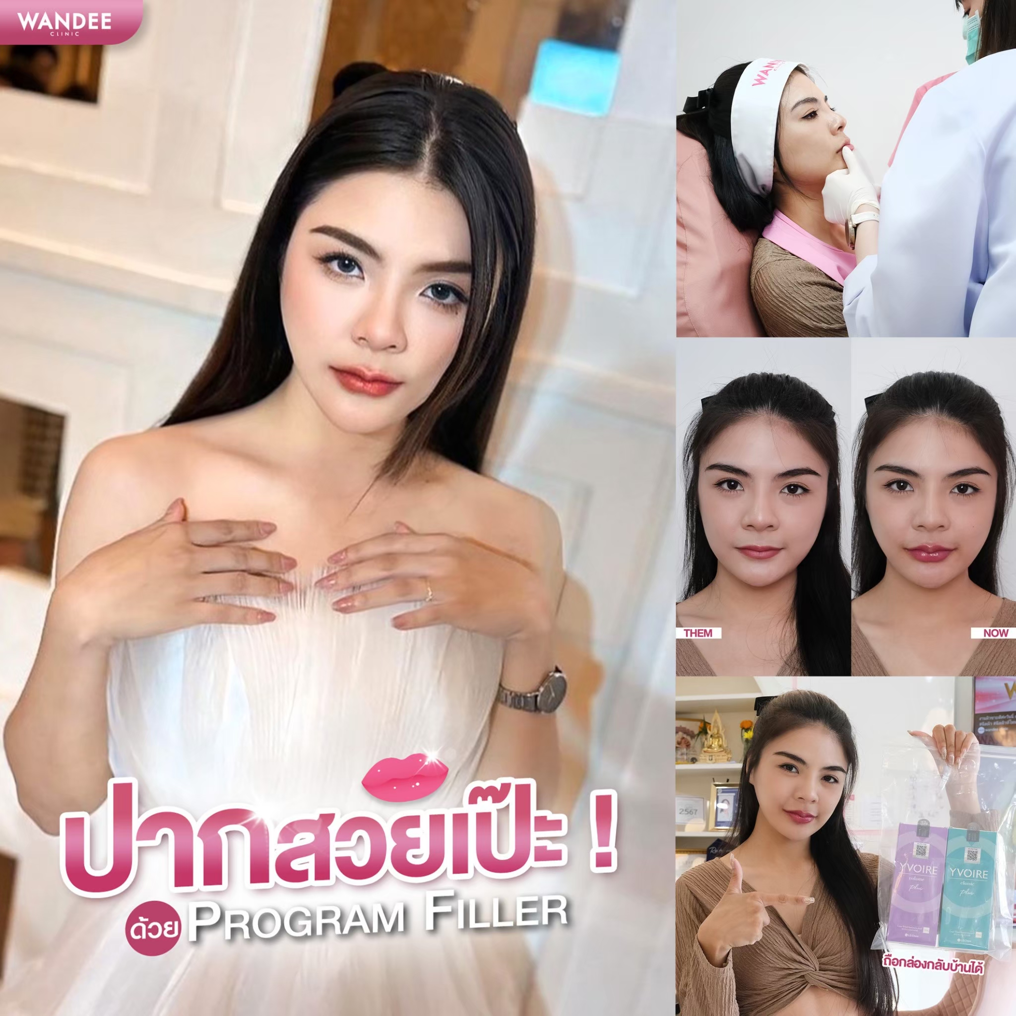 Filler ปาก