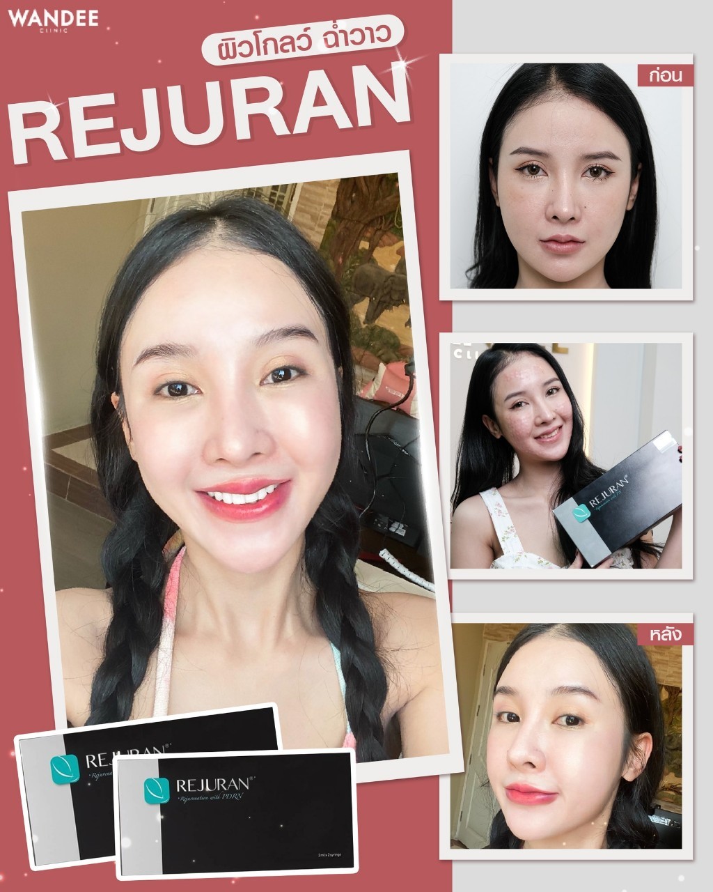 Rejuran Wandee Clinic