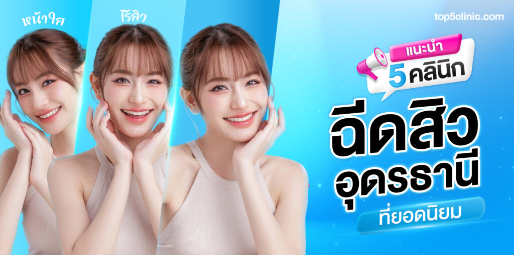 แนะนำ 5 คลินิก ฉีดสิวอุดรธานี ยอดนิยม