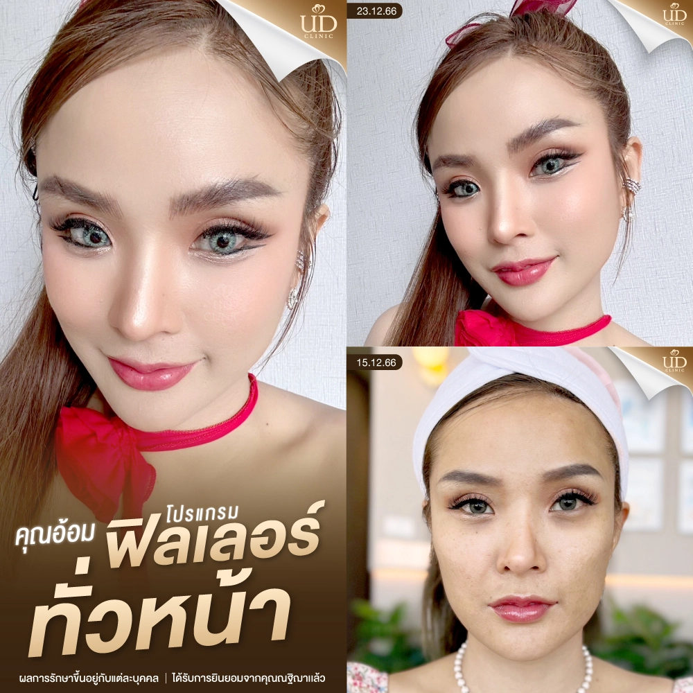 WEB-คุณอ้อม-ฟิลเลอร์