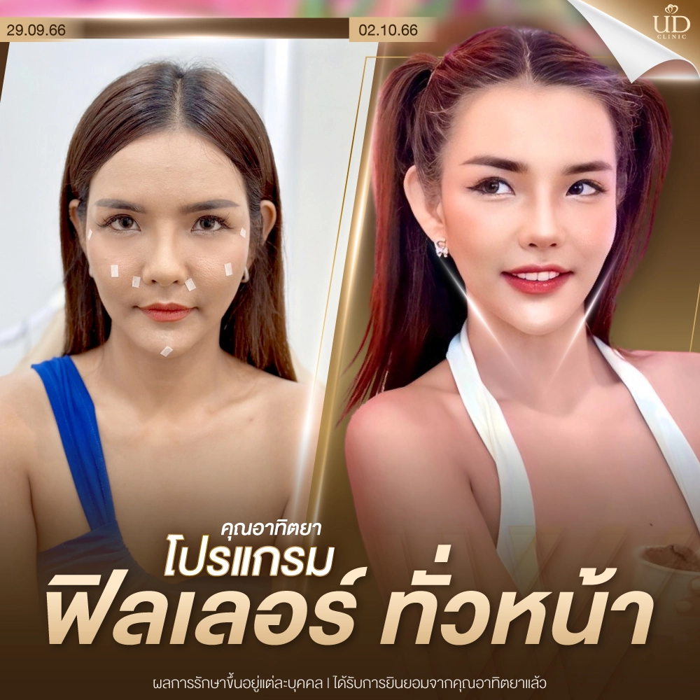 WEB-น้องเฌอแตม-ฟิลเลอร์