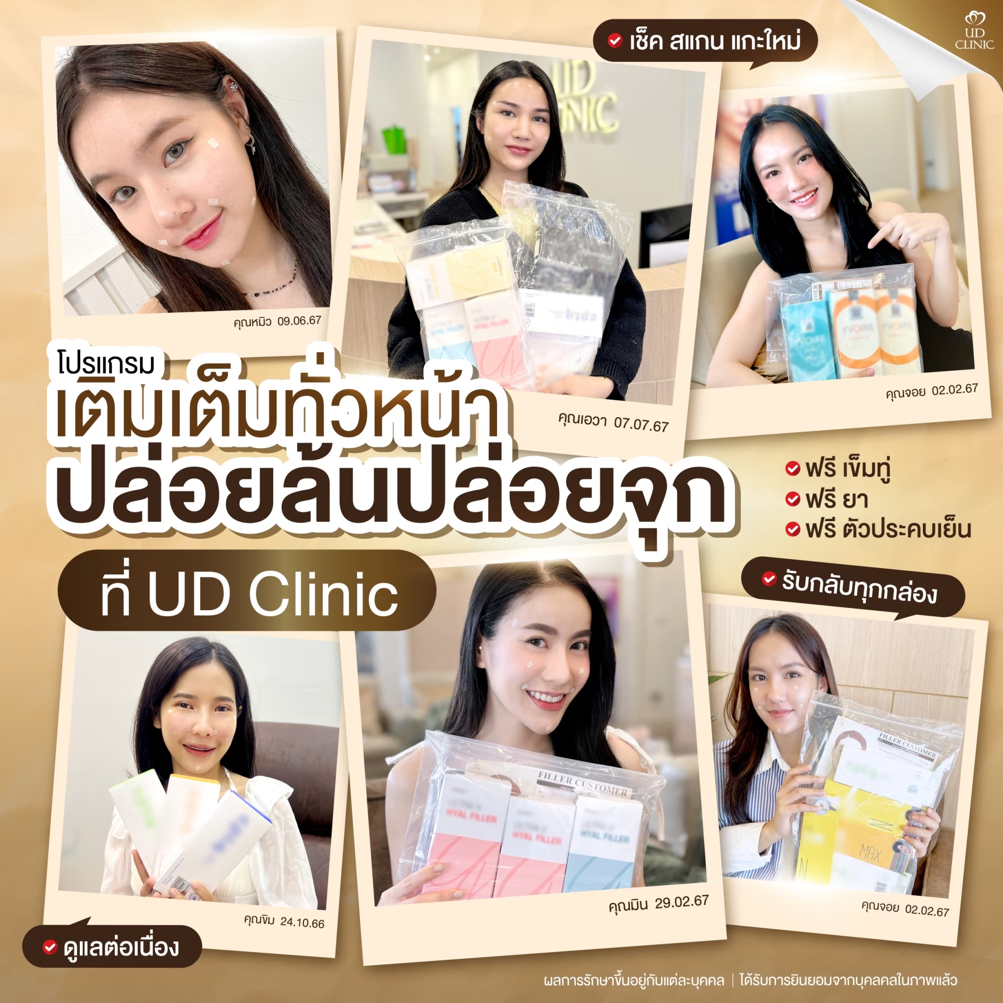 ฟิลเลอร์ud