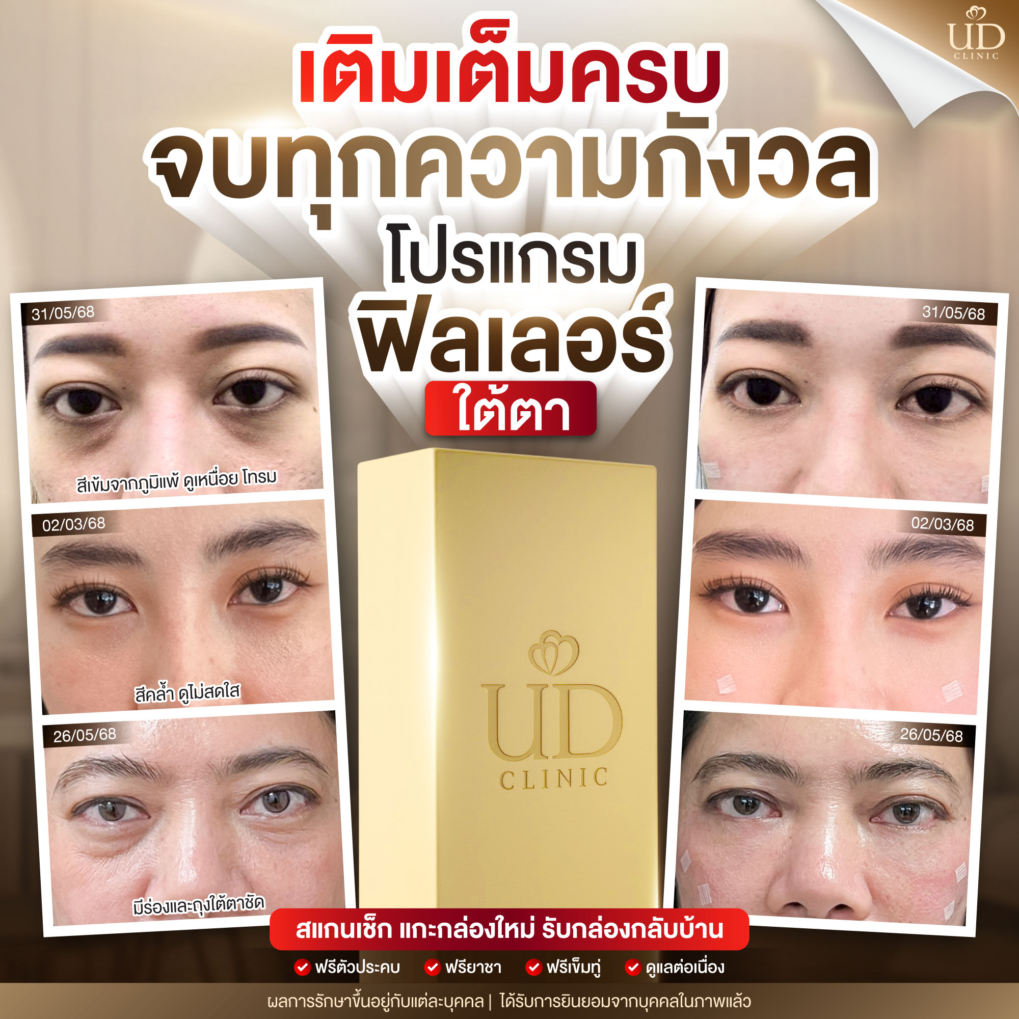 ฟิลเลอร์ud