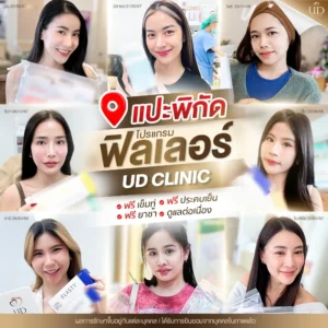 ฉีดฟิลเลอร์ขอนแก่น