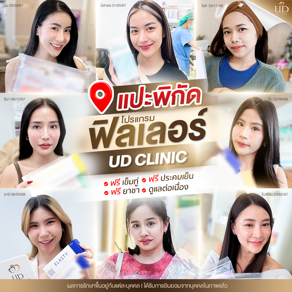 ฟิลเลอร์ud