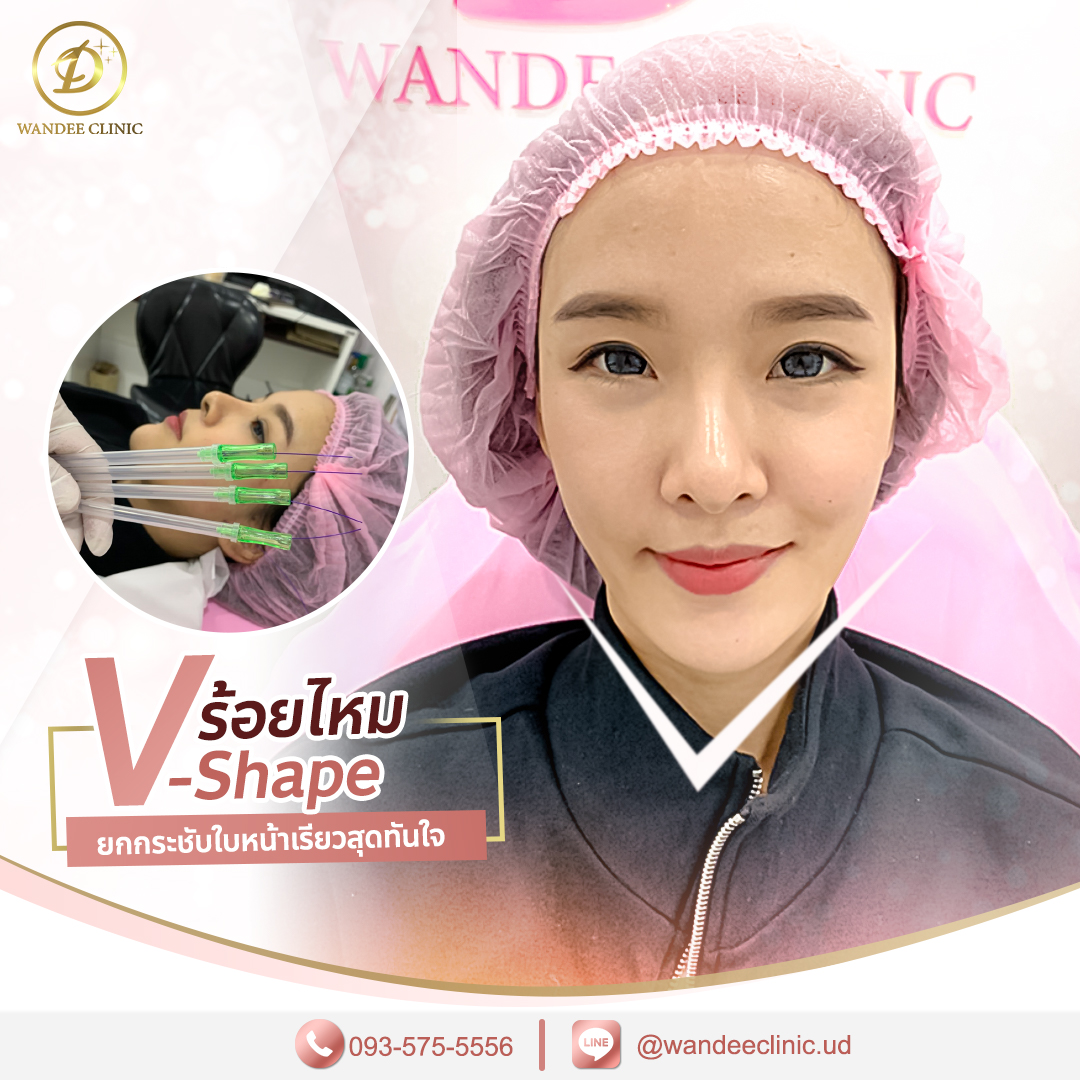 รีวิวร้อยไหม