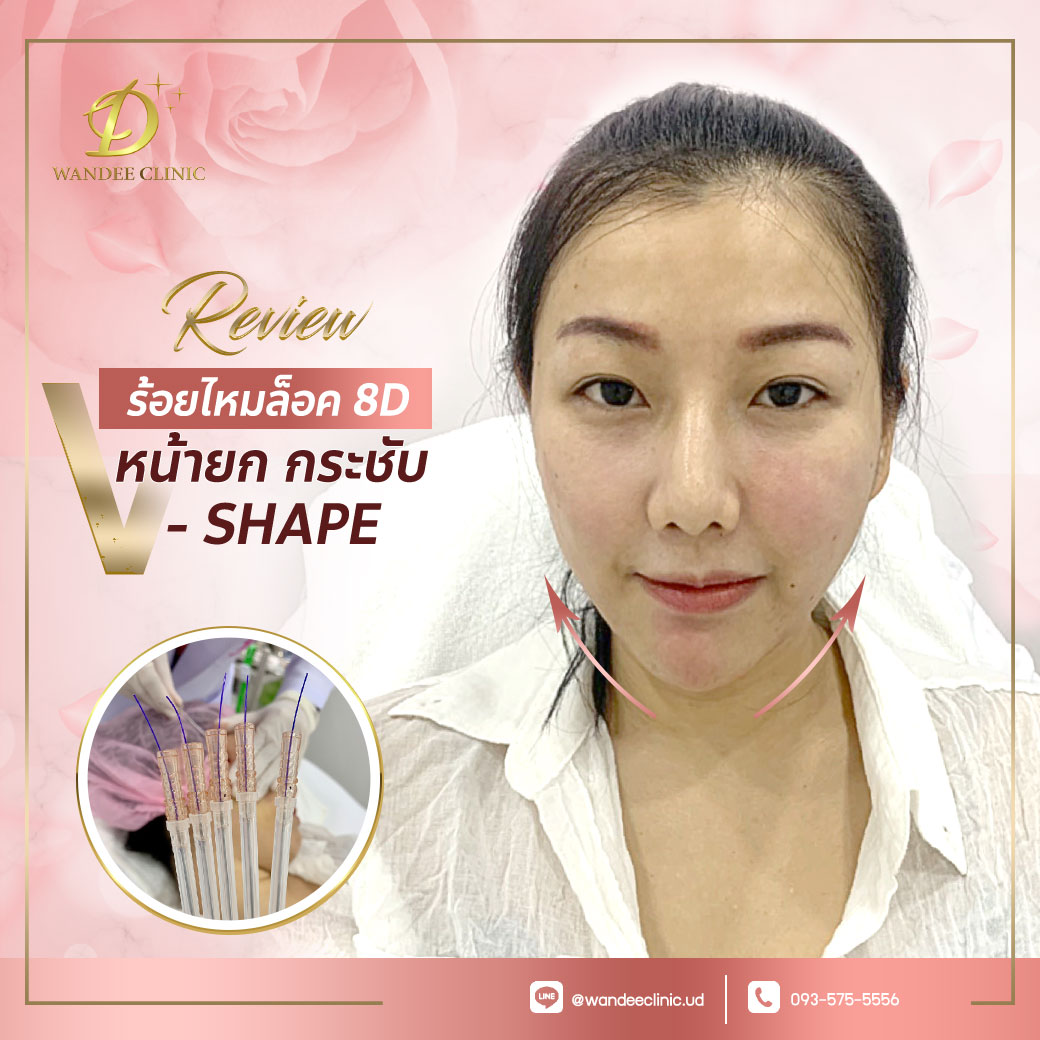 รีวิวร้อยไหม