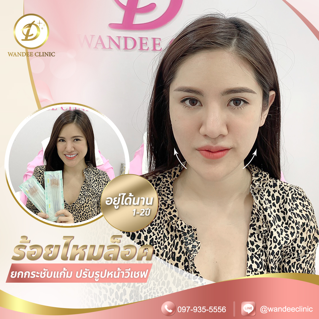 รีวิวร้อยไหม