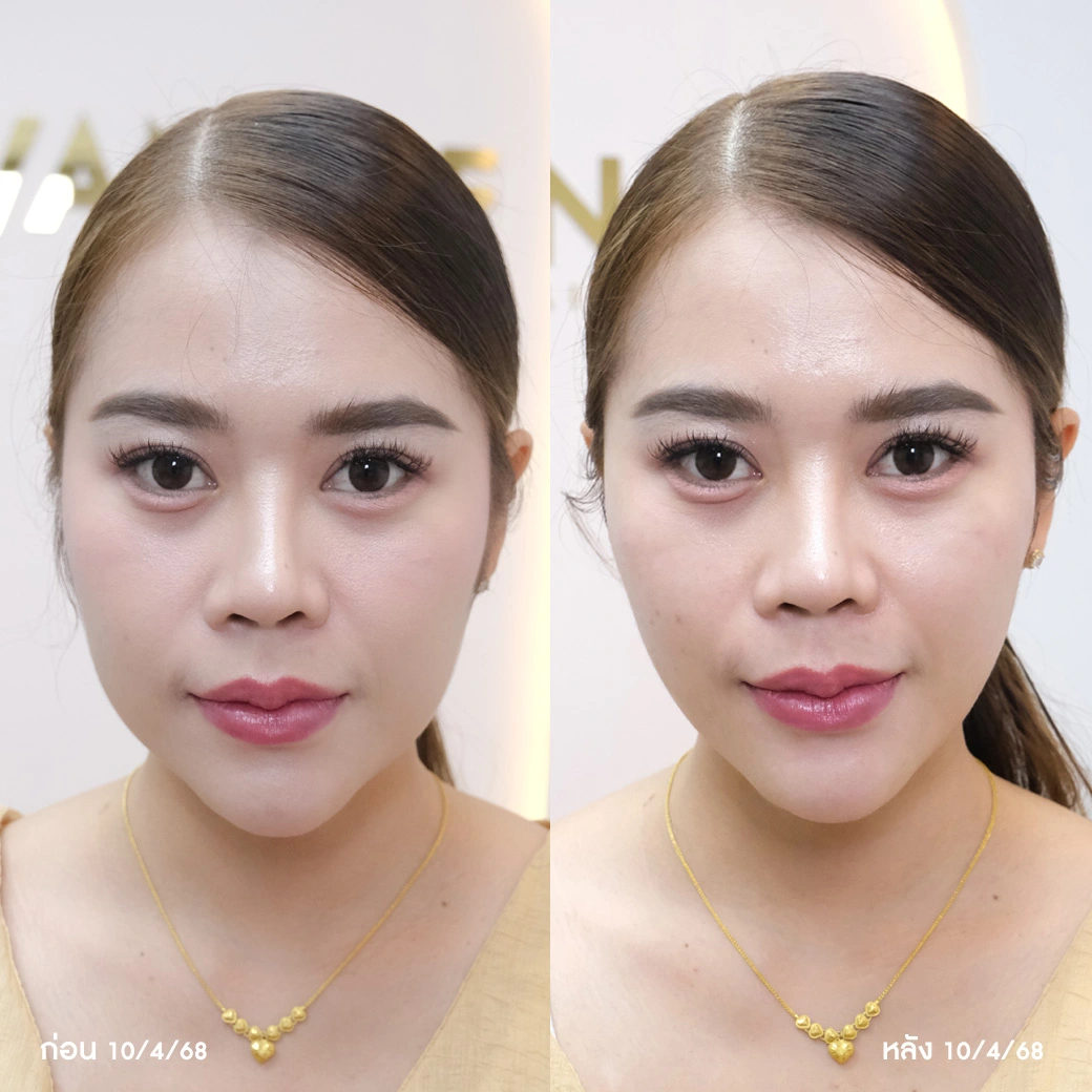 รีวิว แนะนำ 5 คลินิก Oligio ขอนแก่น ที่ได้รับมาตรฐานและความนิยม