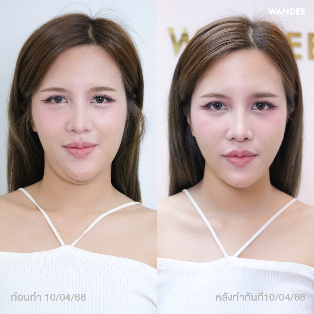 รีวิว แนะนำ 5 คลินิก Oligio ขอนแก่น ที่ได้รับมาตรฐานและความนิยม