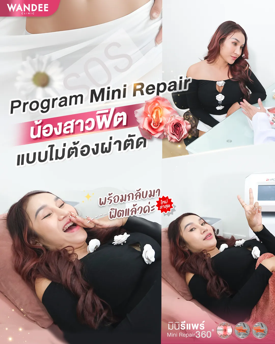 แนะนำ 5 คลินิกมินิรีแพร์พัทยา ชลบุรี ทางเลือกใหม่การกู้คืนน้องสาว