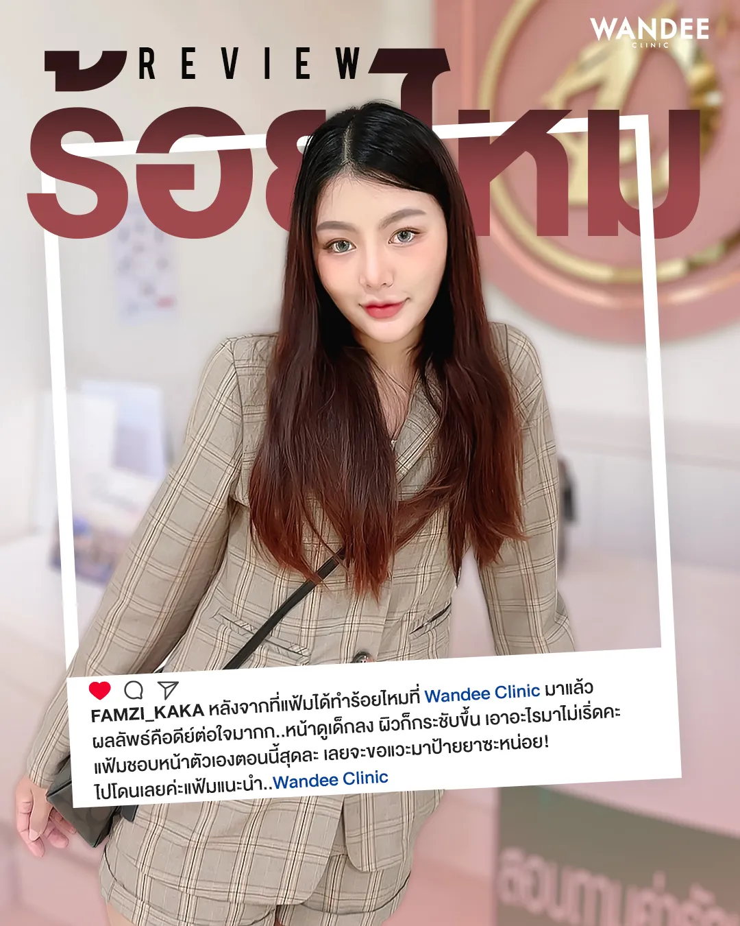 แนะนำ 5 คลินิก ร้อยไหม ขอนแก่น ตึงจริงหรือแค่กระแส