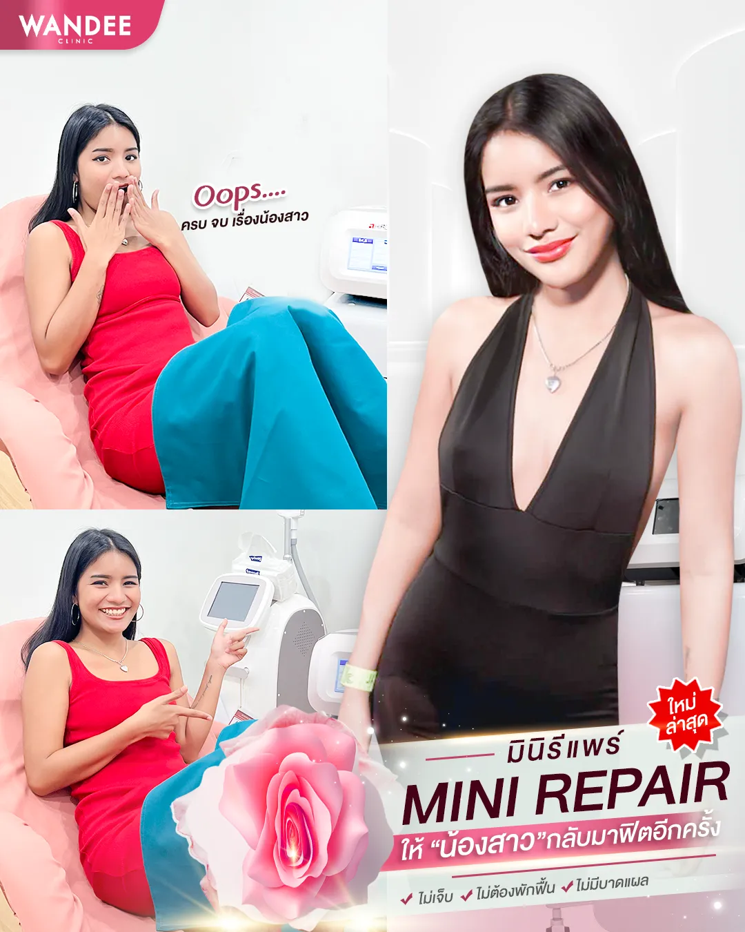 แนะนำ 5 คลินิกมินิรีแพร์พัทยา ชลบุรี ทางเลือกใหม่การกู้คืนน้องสาว