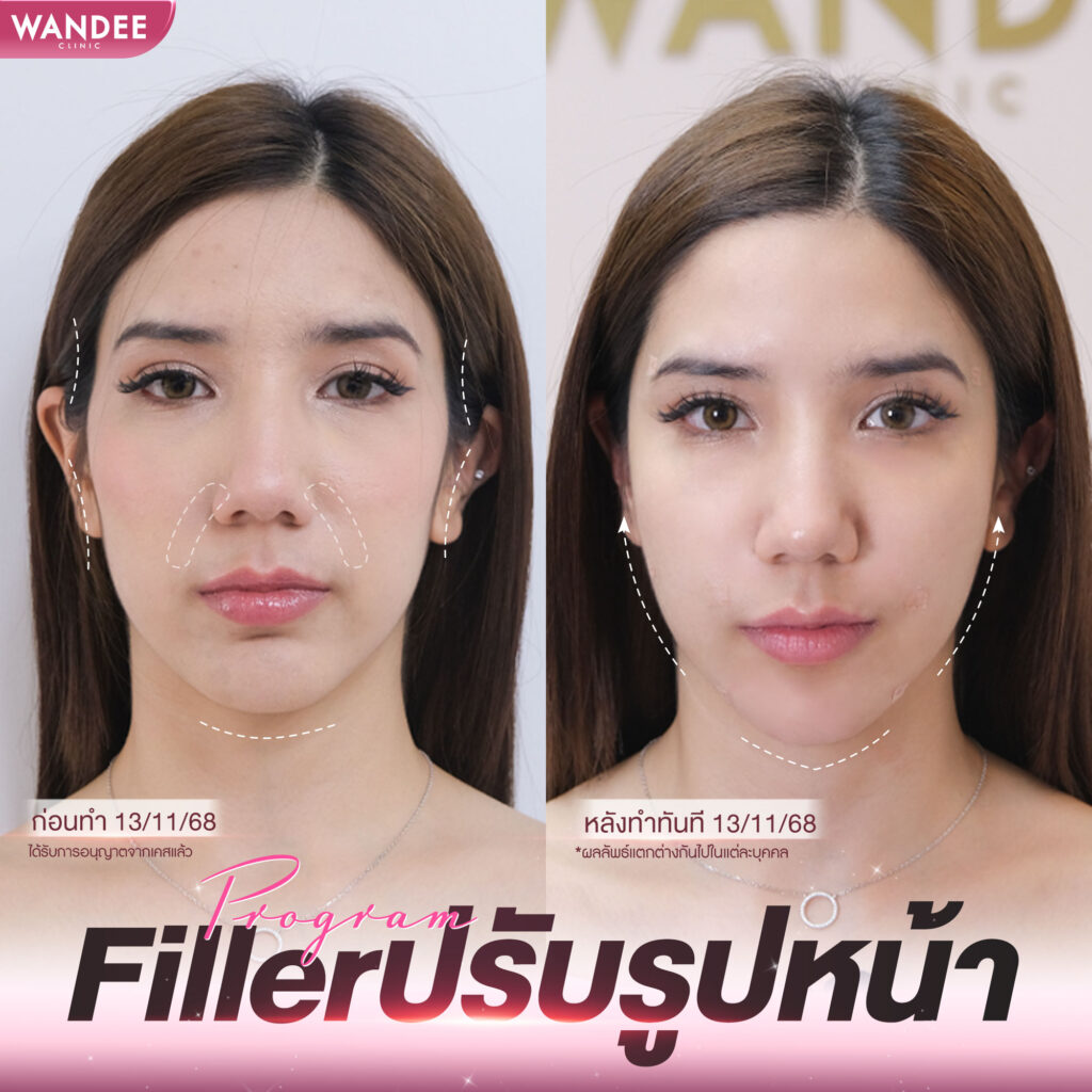 วันดีคลินิก สกล