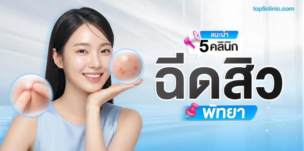 แนะนำ 5 คลินิก ฉีดสิว พัทยา รักษาสิวตรงจุด เห็นผลจริง