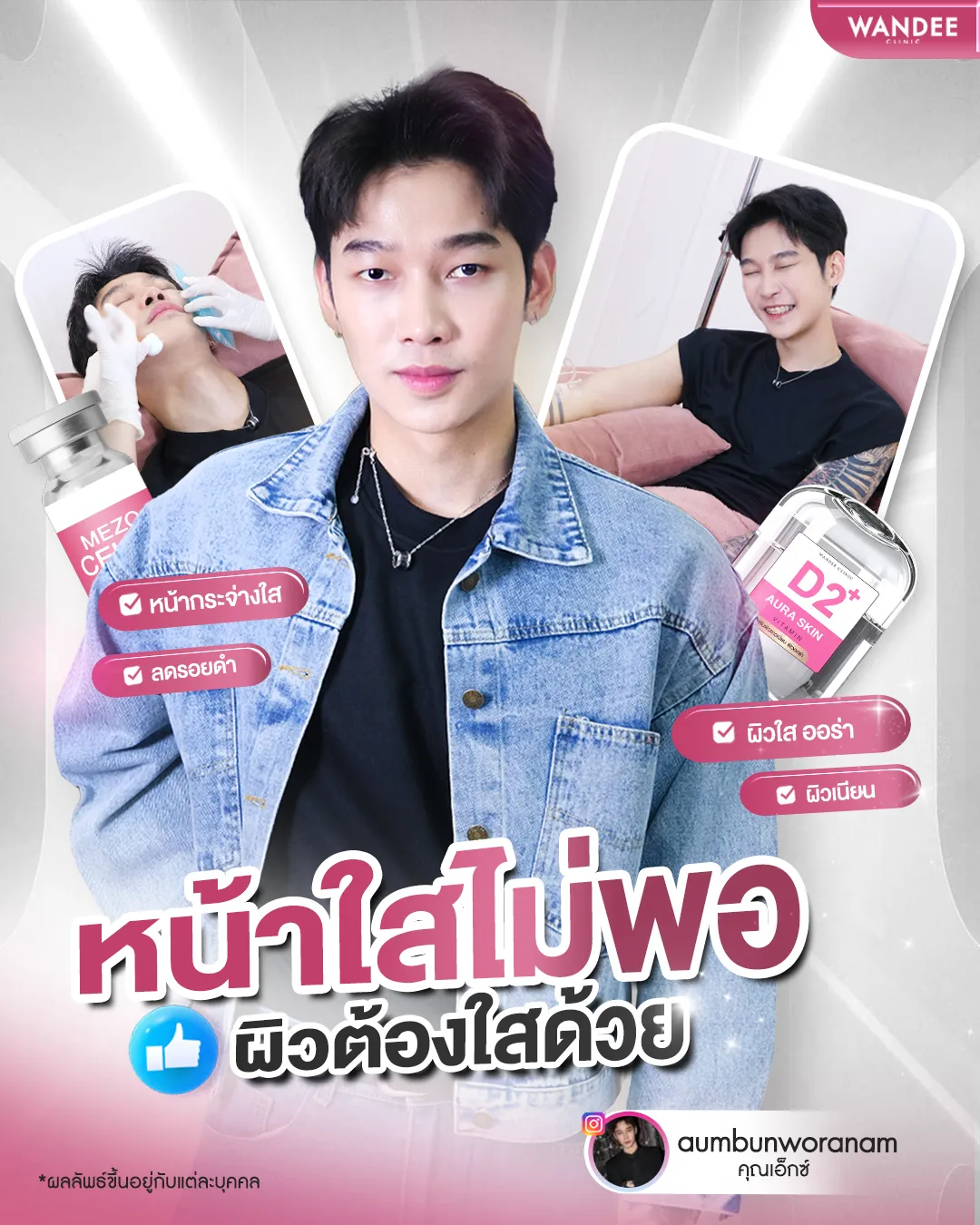 รีวิว เมโสหน้าใส Wandee Clinic