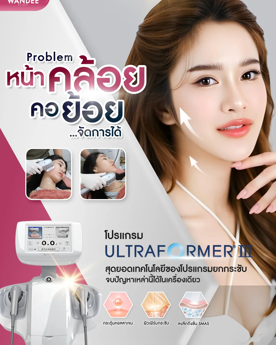 รีวิว Ultraformer Wandee Clinic