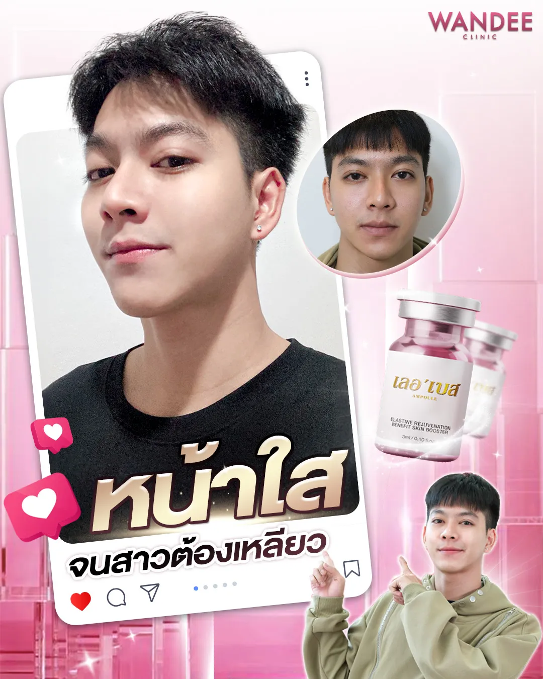 รีวิว เมโสหน้าใส Wandee Clinic