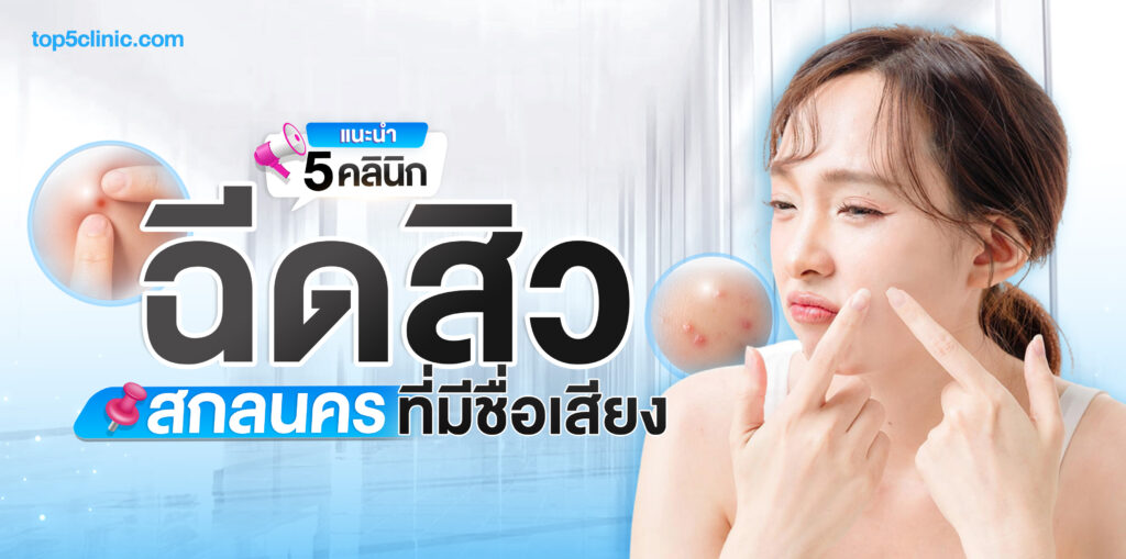 ฉีดสิว สกลนคร