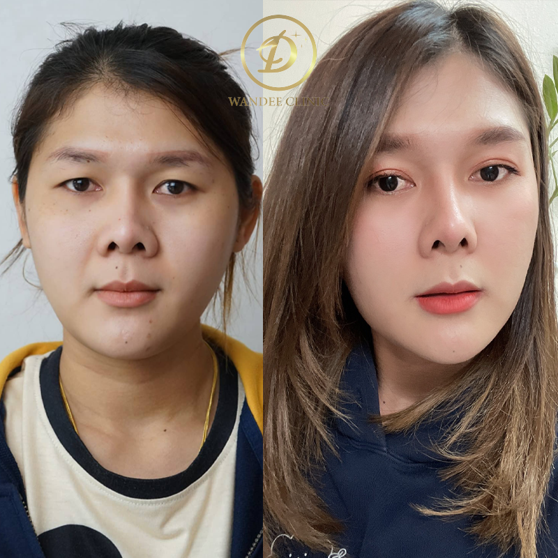 ตา 2 ชั้น สกลนคร