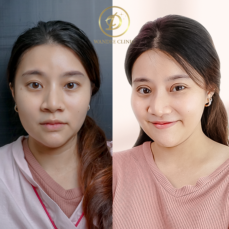 ตา 2 ชั้น สกลนคร