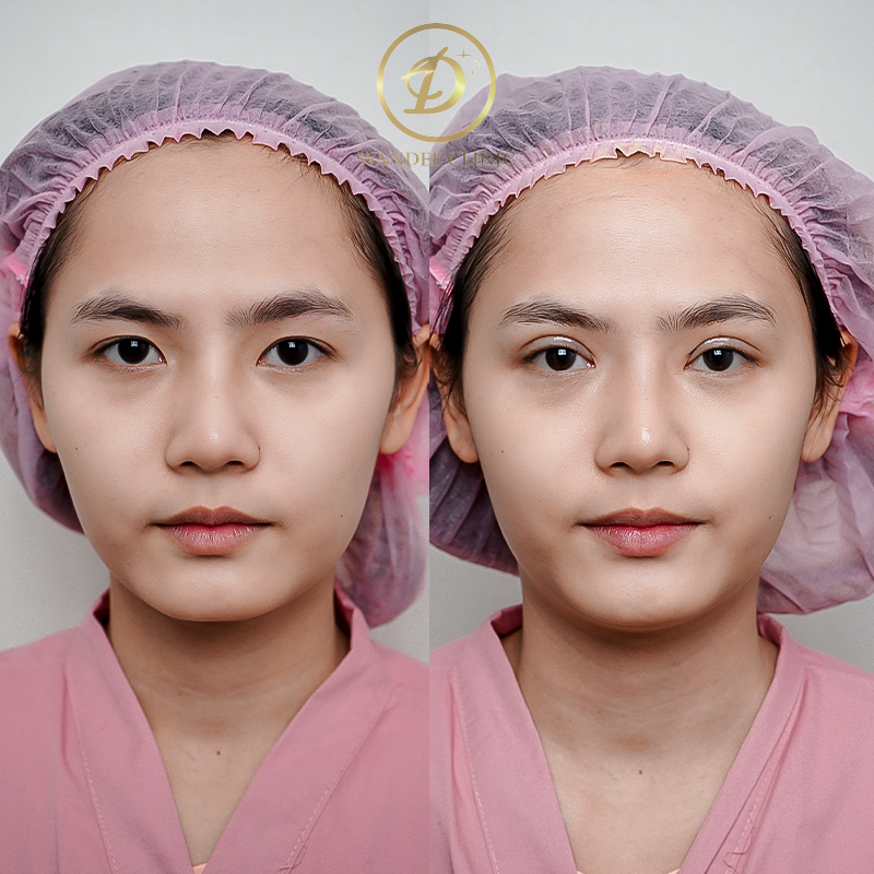 ตา 2 ชั้น สกลนคร