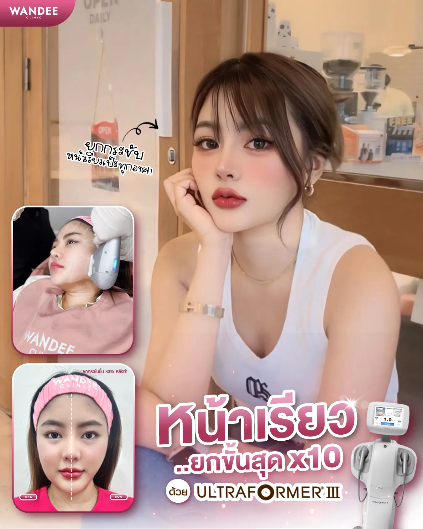 รีวิว Ultraformer ที่ Wandee Clinic