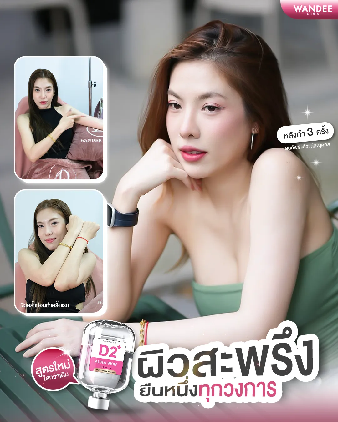 รีวิวดริป vitamin ผิว Wandee Clinic