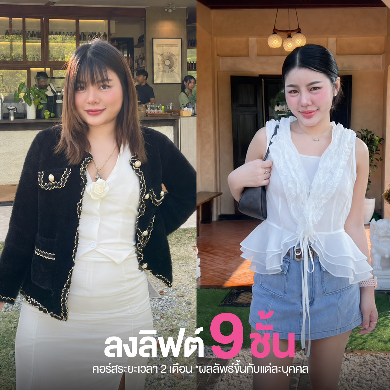 รีวิวปักปากกาลดน้ำหนัก วันดี คลินิก