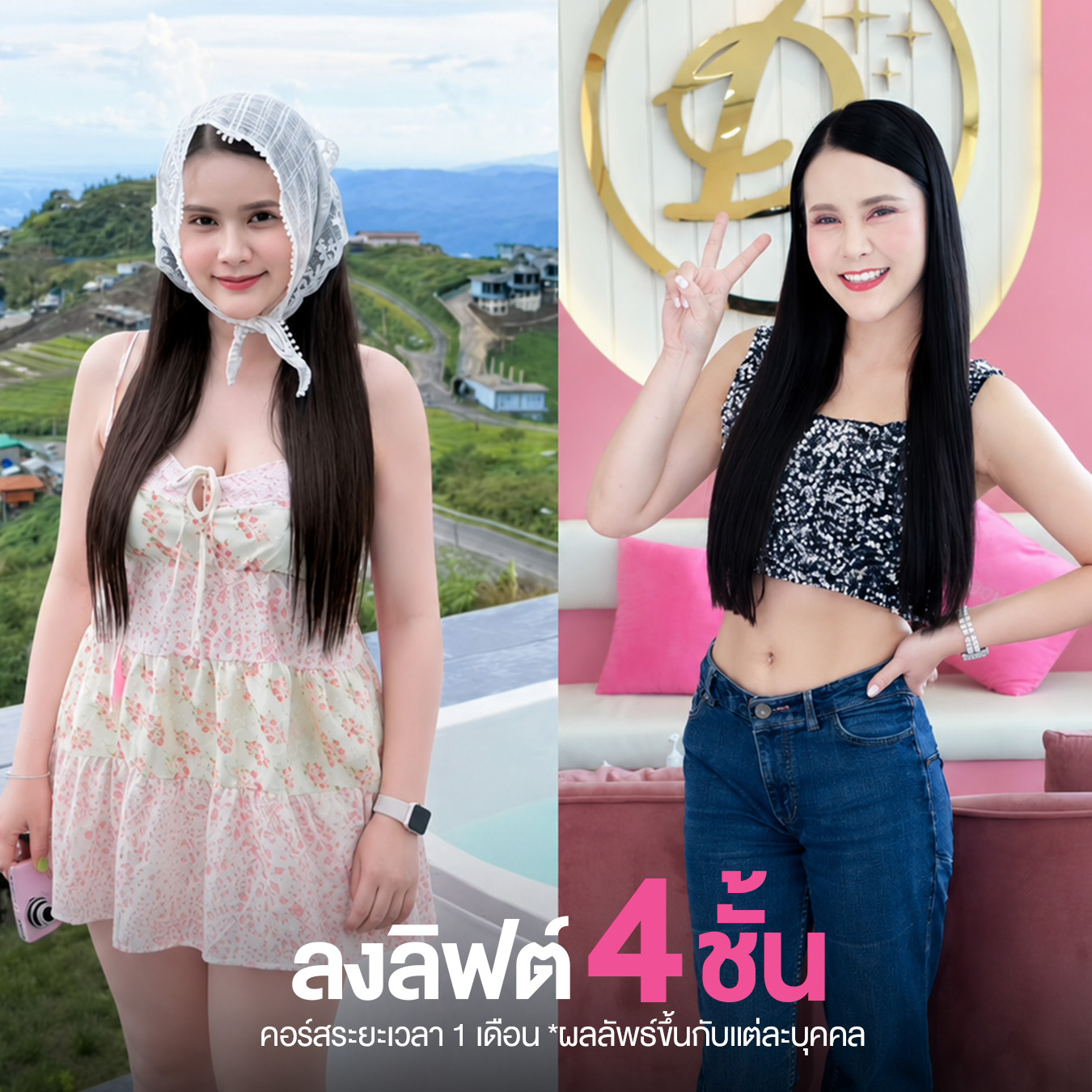 รีวิวปักปากกาลดน้ำหนัก วันดี คลินิก