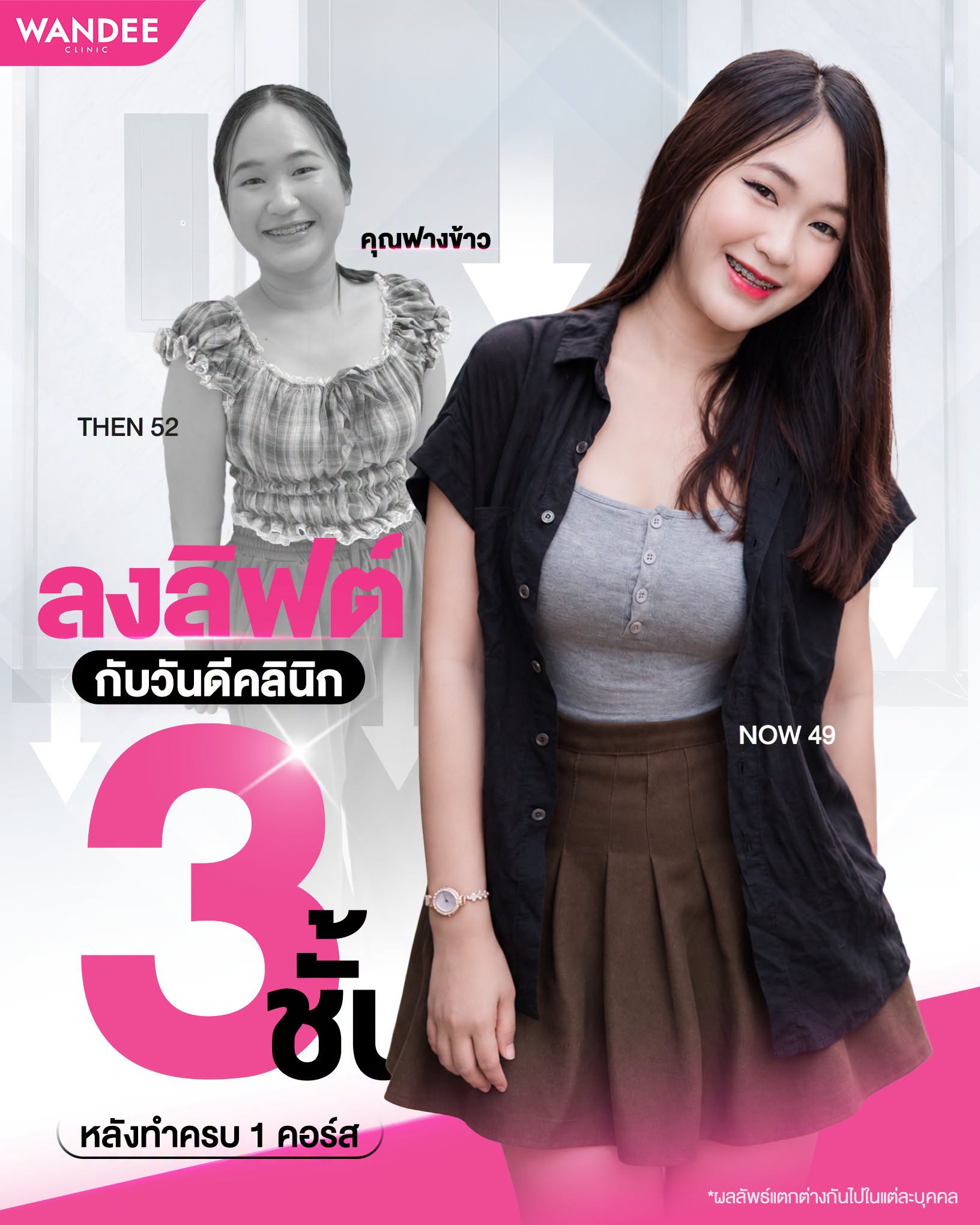 ล็อคหุ่น 𝗦 ที่ 𝗪𝗮𝗻𝗱𝗲𝗲 𝗖𝗹𝗶𝗻𝗶𝗰